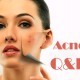 quelles sont les questions que vous vous posez à propos de votre acné